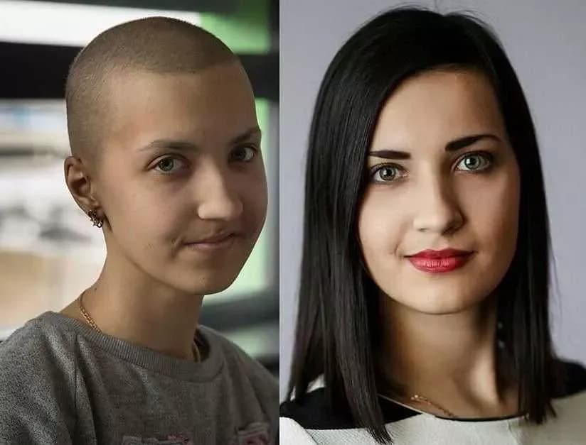 Po jakim czasie można farbować włosy po chemioterapii? Dowiedz się teraz!